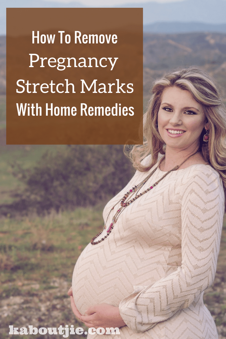 9 Ways To Remove Pregnancy Stretch Marks With Home Remedies