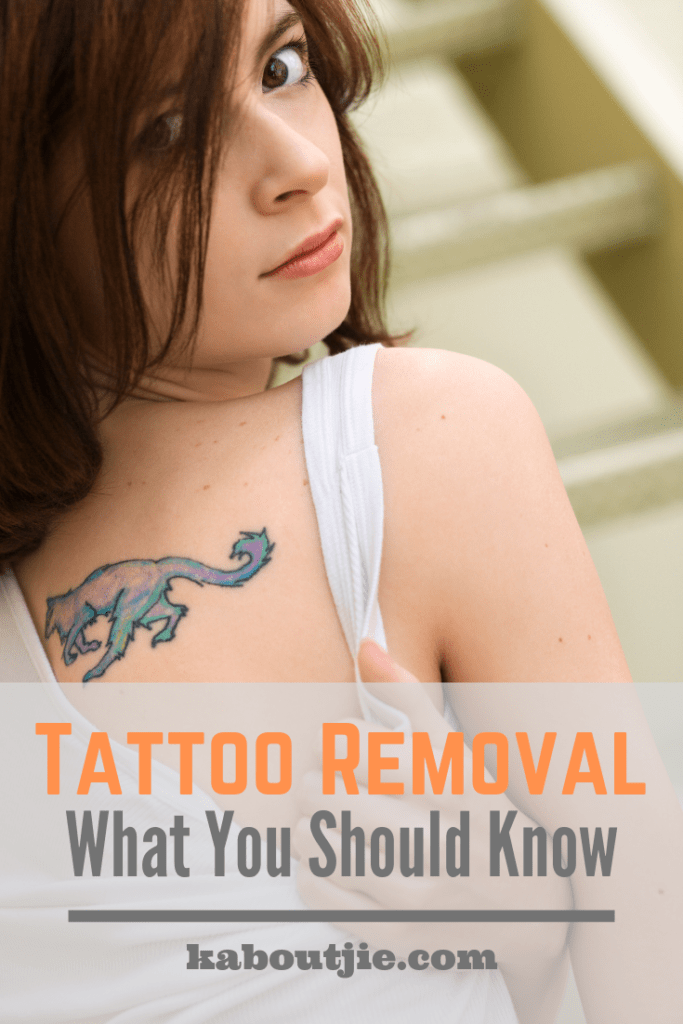 Tattoo Removal - What You Need To Know