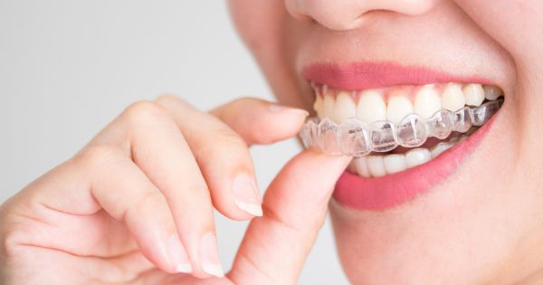 Invisalign retainers